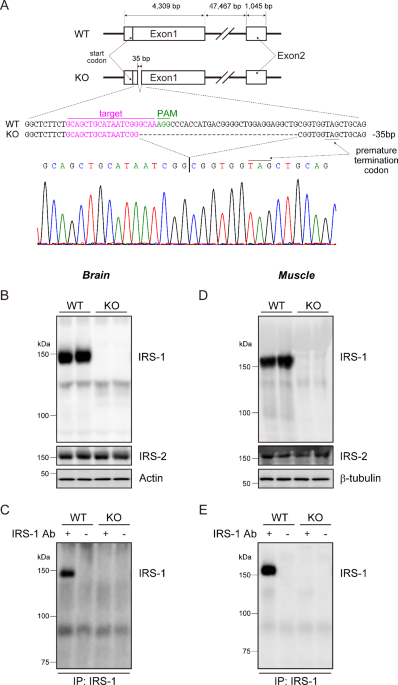 Deletion of IRS-1 leads to growth failure and insulin resistance with downregulation of liver and muscle insulin signali