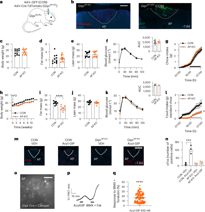 Distinct brain regions mediate regulation of food intake in response to GIPR agonism or antagonism