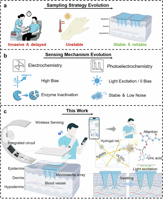 Wireless light-gated photoelectrochemical microneedle wearables for zero-bias longitudinal monitoring in interstitial fl