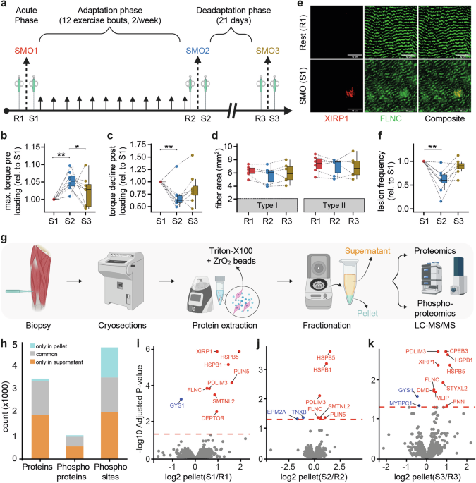 Fractionated proteomics identifies a protein network mitigating resistance exercise-induced damage in human skeletal mus