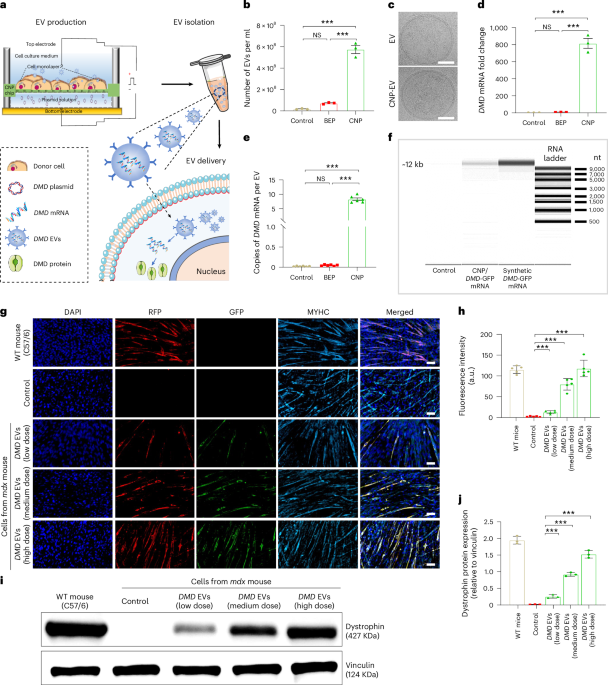 Skeletal-muscle-targeted non-viral delivery of full-length DMD mRNA for Duchenne muscular dystrophy
