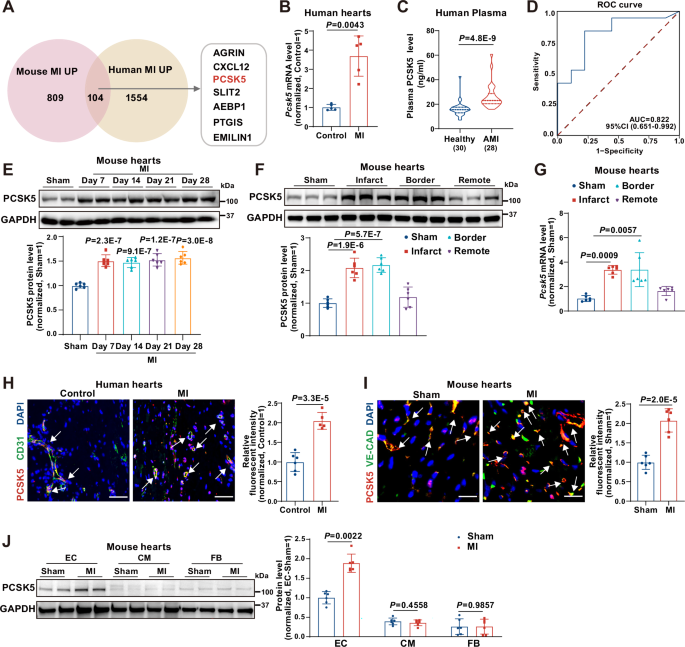 PCSK5 promotes angiogenesis and cardiac repair after myocardial infarction
