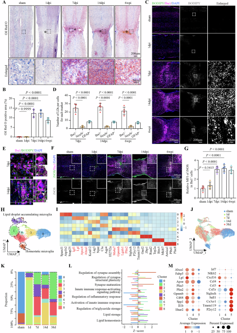 PLIN2-PGAM5-regulated lipid droplet-mitochondria contacts drive microglial neuroinflammation after spinal cord injury vi