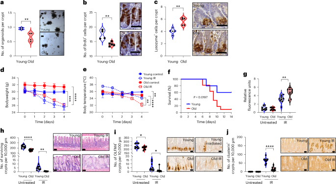 TNFR1 signaling connects inflammation to impaired fatty acid oxidation to drive intestinal stem cell aging