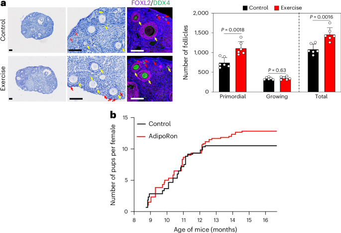 Exercise slows ovarian aging