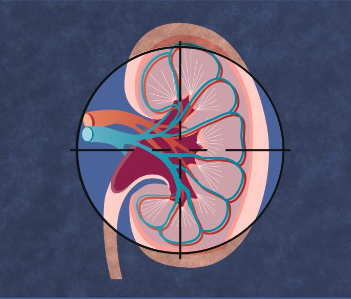 Benefits of finerenone treatment across chronic kidney disease aetiologies