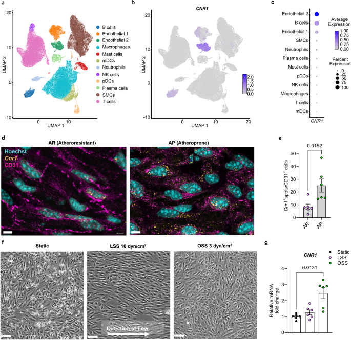 Endothelial cannabinoid CB1 receptor deficiency reduces shear stress-induced arterial inflammation and lipid uptake