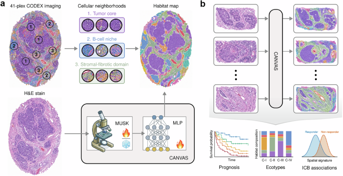 Reading tumor ecosystems from routine histology
