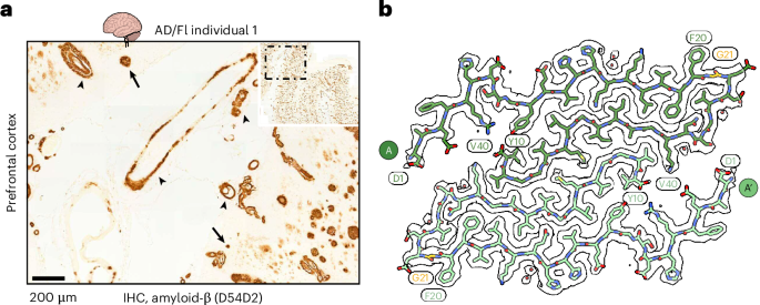 Alzheimer’s disease-linked Flemish APP mutation defines a distinct amyloid-β fold